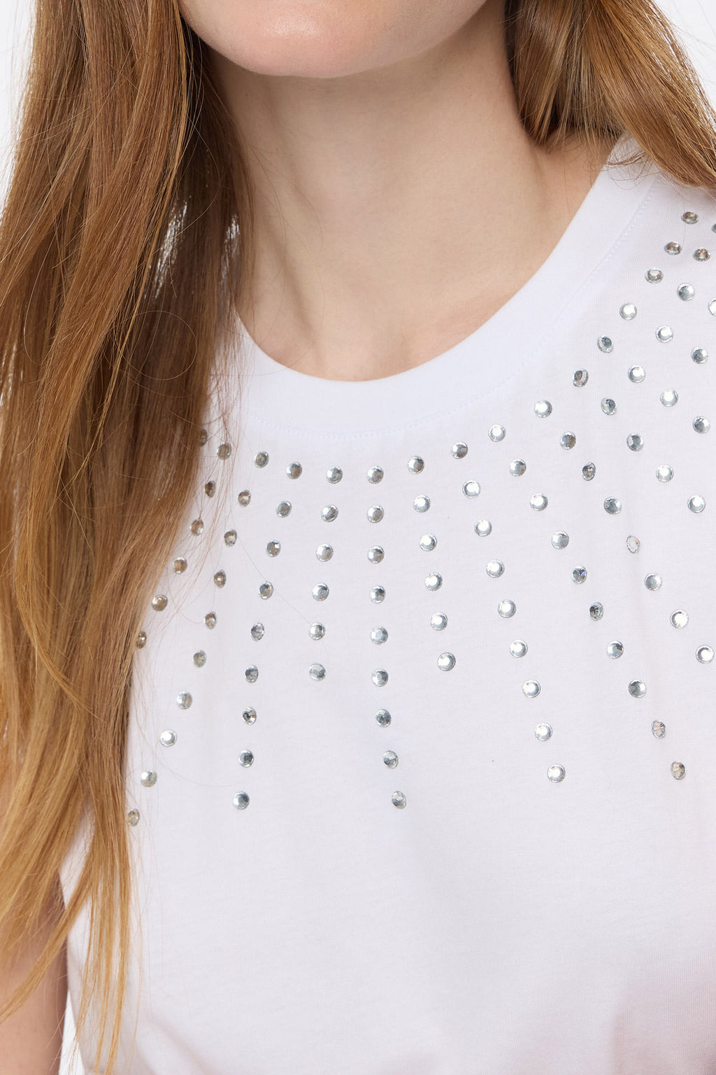 Musculosa Radial